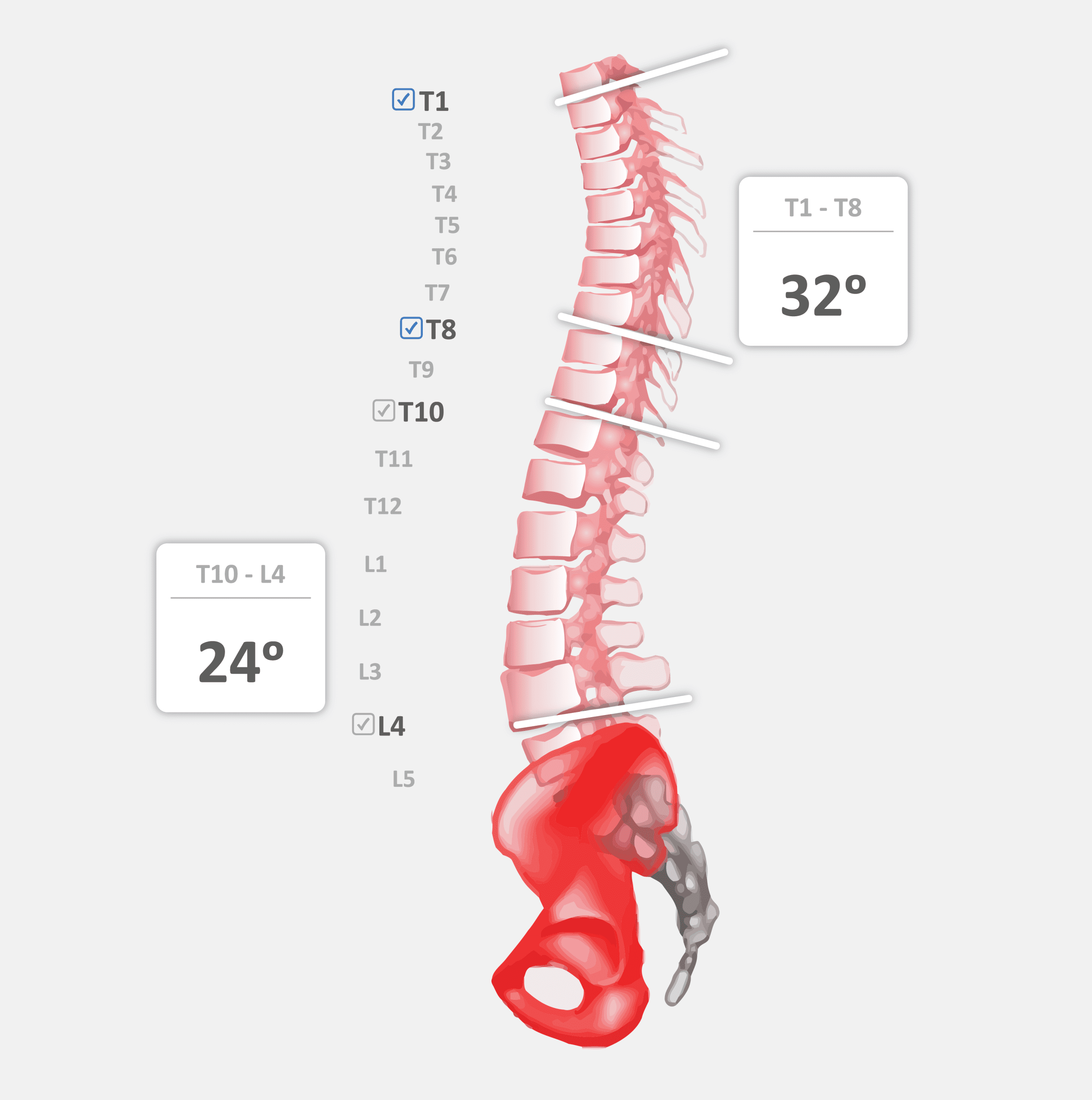 Análisis postural 3D MotiPhysio — Clínica Podogral Barcelona